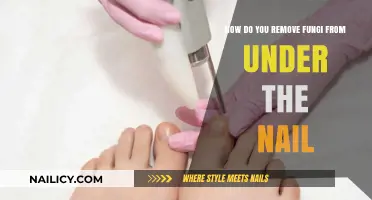 Eradicate Fungi Under Nails: Effective Home Remedies