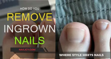 Relief from Ingrown Nails: Simple Home Remedies and Tips