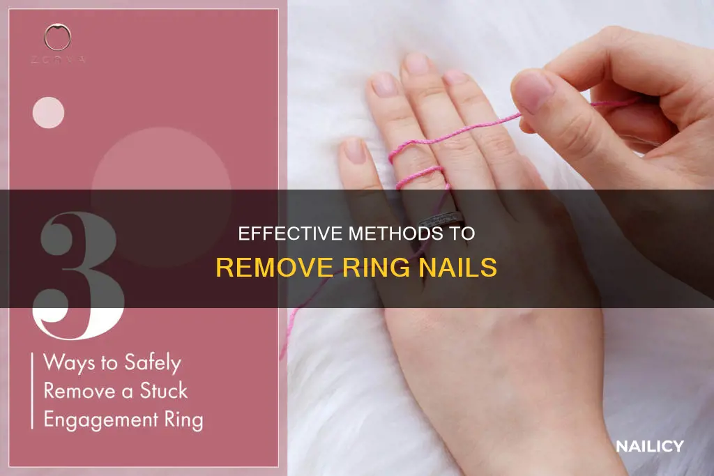 how do you remove ring nails