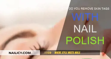 Effective Skin Tag Removal Using Nail Polish