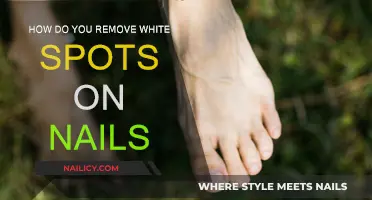 Get Rid of White Spots on Nails