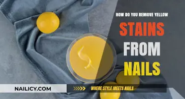 Erase Yellow Nail Stains: Effective Home Remedies