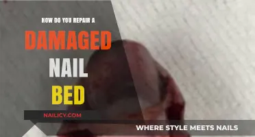 Heal and Restore: Effective Ways to Repair a Damaged Nail Bed