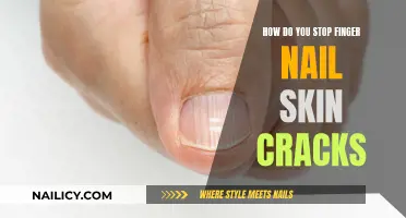 Healing Cracked Fingernails: Tips for Soft, Healthy Skin