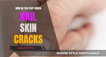 Preventing Finger Nail Skin Cracks: Tips for Healthy Hands