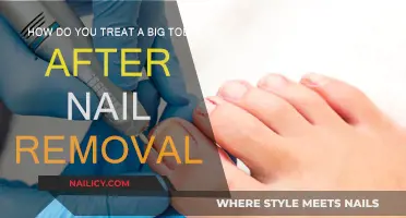 Healing Your Big Toe: Post-Nail Removal Care
