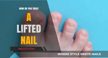 Effective Treatment Options for a Lifted Nail: A Comprehensive Guide