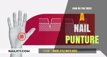 Effective Treatment Steps for a Painful Nail Puncture Wound