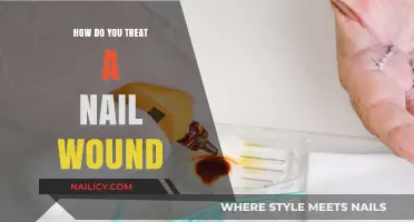 Effective Nail Wound Treatment: Quick Steps for Healing and Prevention