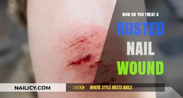 Treating Rusted Nail Wounds: Essential Steps for Safe Healing and Prevention