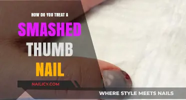 Smashed Thumb Nail Treatment: Quick Relief and Healing Tips