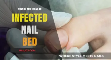 Effective Treatment Options for Healing an Infected Nail Bed