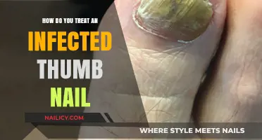 Treating an Infected Thumb Nail: Effective Remedies and Care Tips