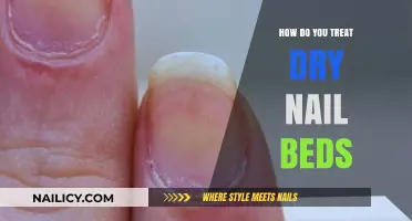 Effective Remedies for Dry Nail Beds: Hydration and Care Tips