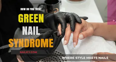 Effective Treatment Strategies for Green Nail Syndrome: A Comprehensive Guide