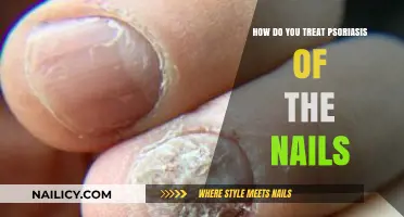 Effective Treatments for Nail Psoriasis: Relief and Management Strategies