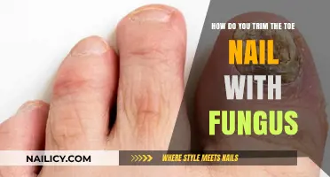 Trimming Infected Toenails: A Step-by-Step Guide