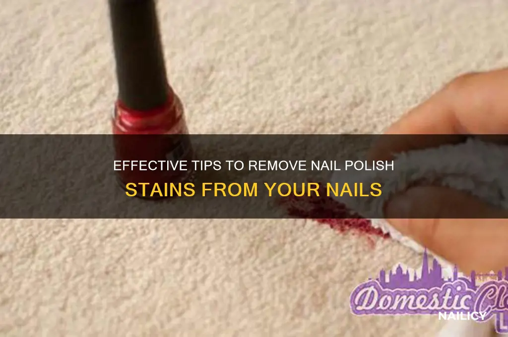 how do you unstain your nails from nail polish