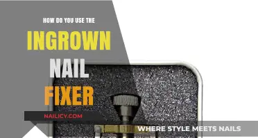 Effective Steps to Fix an Ingrown Nail at Home
