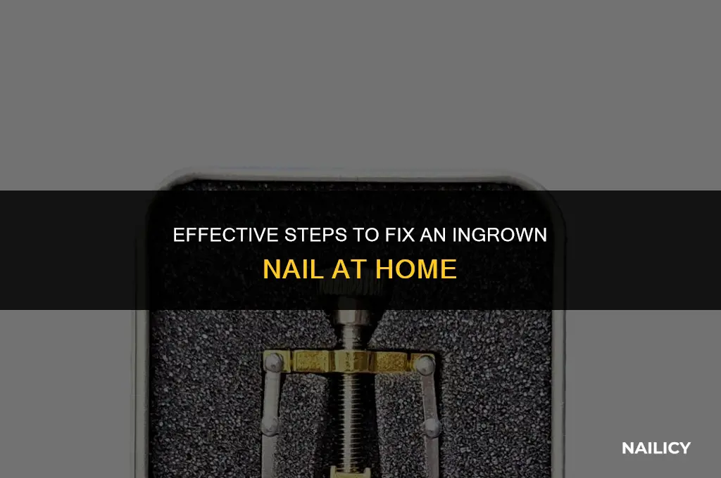 how do you use the ingrown nail fixer