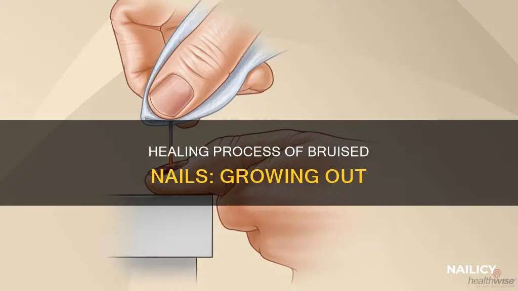 how does a bruised nail grow out