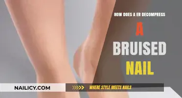 Effective ER Techniques to Relieve Pain from a Bruised Nail