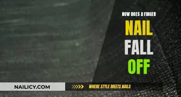 The Mystery of Fingernails Falling Off: An Explanation