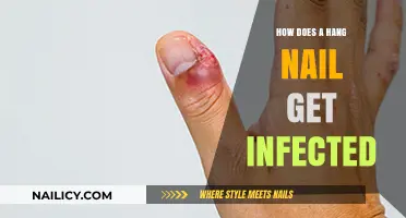 Understanding Hang Nail Infections: Causes, Symptoms, and Treatments
