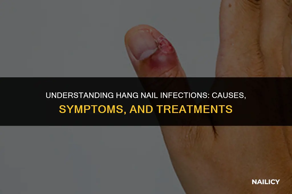 how does a hang nail get infected