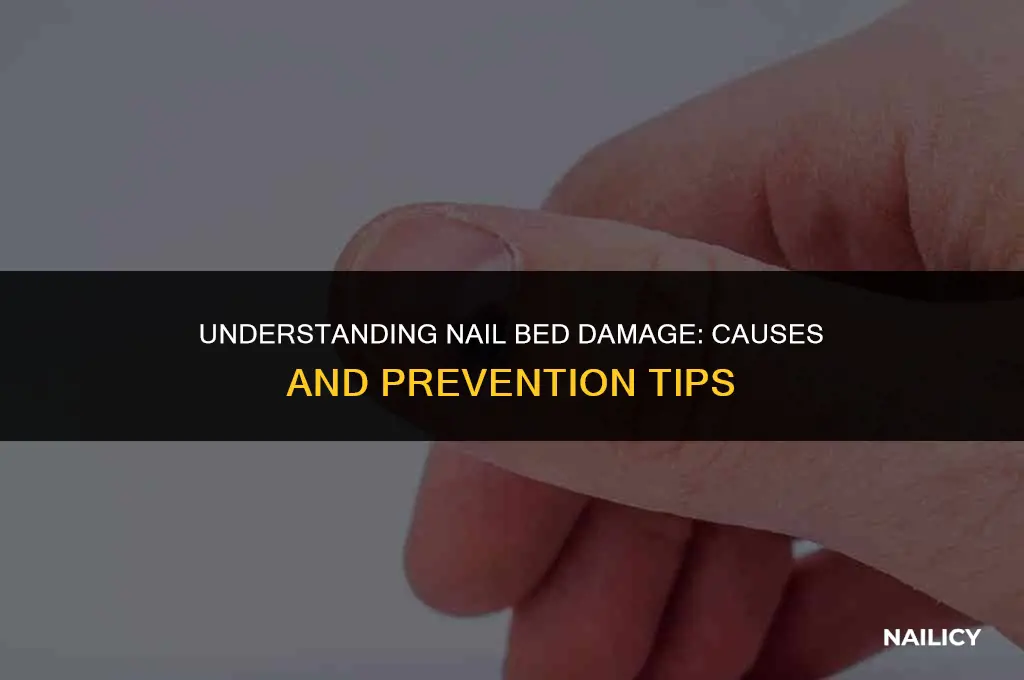 how does a nail bed get damaged
