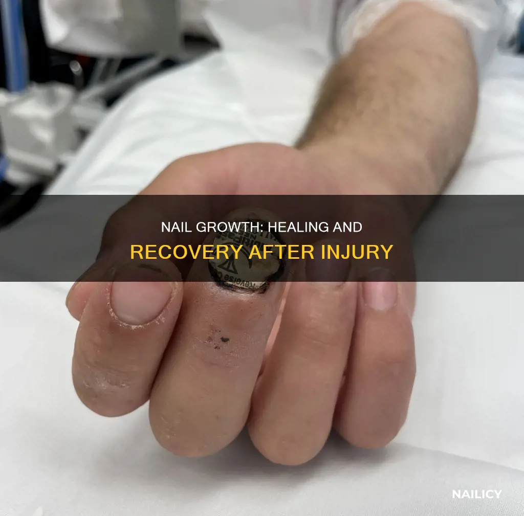 how does a nail grow after injury