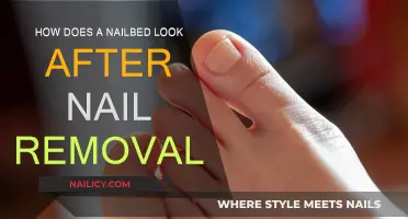 Exploring Nail Bed Appearance Post-Nail Removal