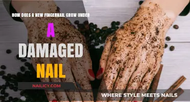 Damaged Nail: How Does a New Fingernail Grow?