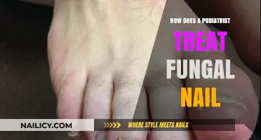 Effective Podiatrist Treatments for Fungal Nails: Expert Solutions and Care