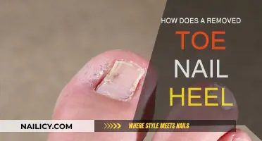 Healing Process After a Toenail Removal