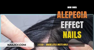 Alopecia's Impact: Understanding Nail Changes and Their Connection