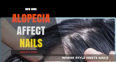 Alopecia's Impact: Understanding Nail Changes and Their Significance