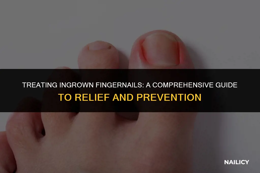 how does an ingrown finger nail get treated