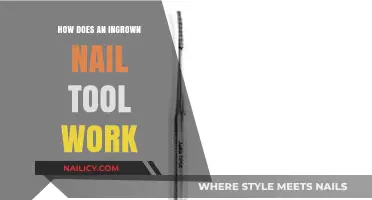 Understanding Ingrown Nail Tools: How They Work and Why They Help