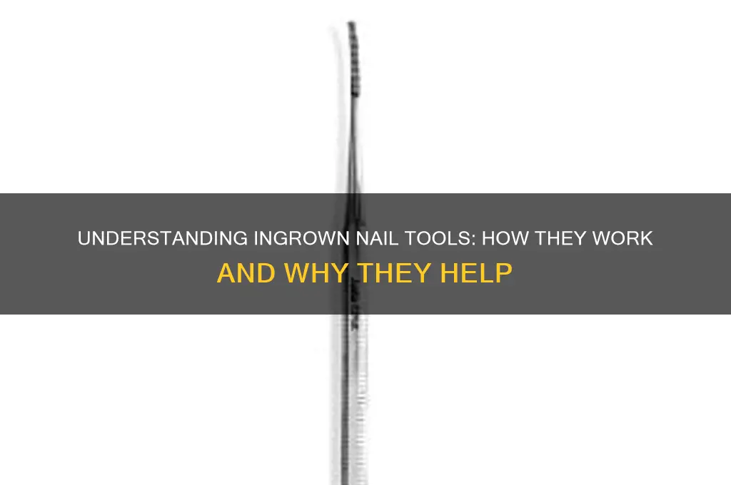 how does an ingrown nail tool work