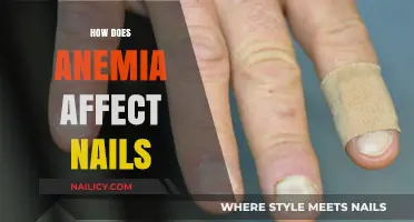 Anemia's Impact: Understanding How It Affects Nail Health and Appearance