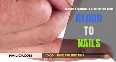 Unraveling the Journey: Bartonella Henselae's Path from Bloodstream to Nails