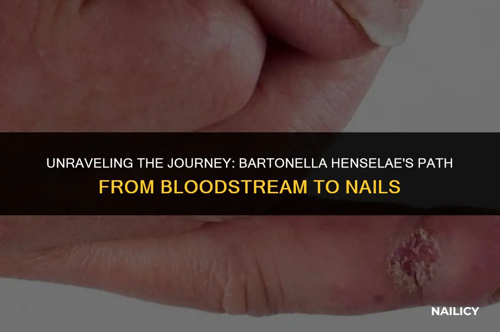 how does bartonella henselae get from blood to nails