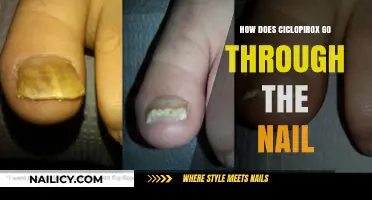 Understanding Ciclopirox Penetration: How It Effectively Treats Nail Infections