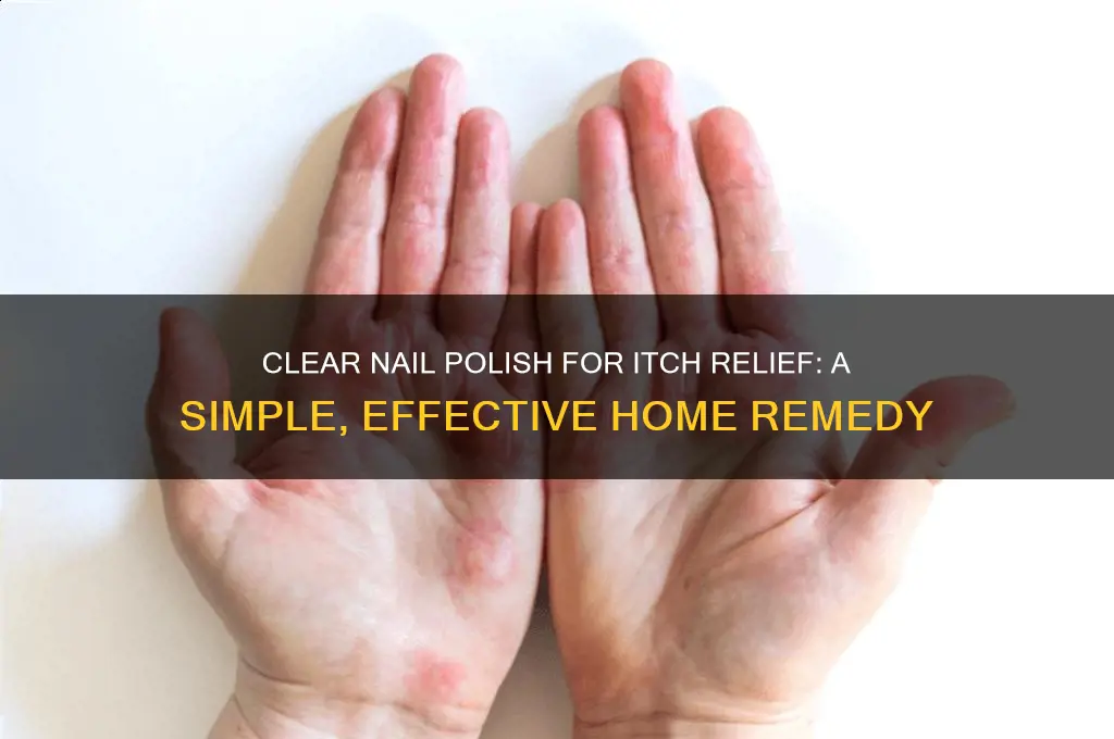 how does clear finger nail polish help itching