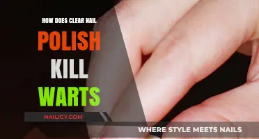 Clear Nail Polish Wart Removal: A Simple, Effective DIY Treatment