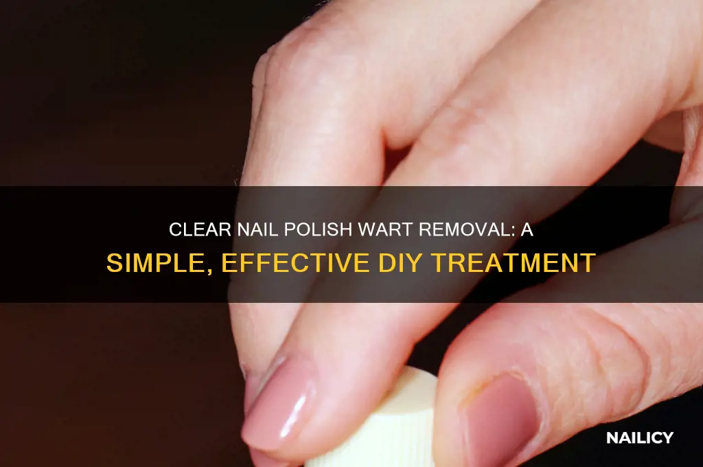 how does clear nail polish kill warts