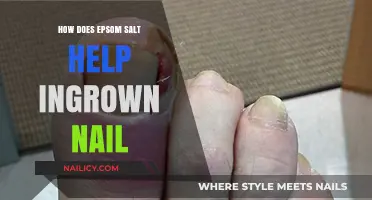 Epsom Salt's Soothing Relief for Ingrown Nails: A Natural Remedy