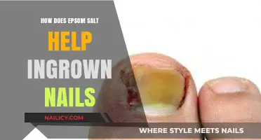 Epsom Salt's Soothing Relief for Painful Ingrown Toenails Explained