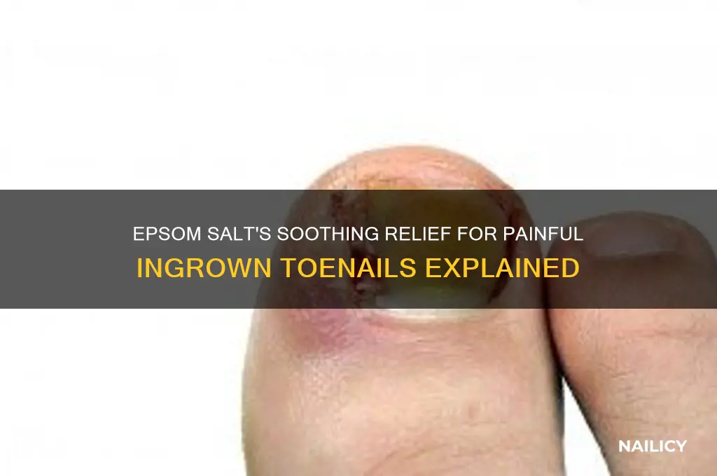 how does epsom salt help ingrown nails